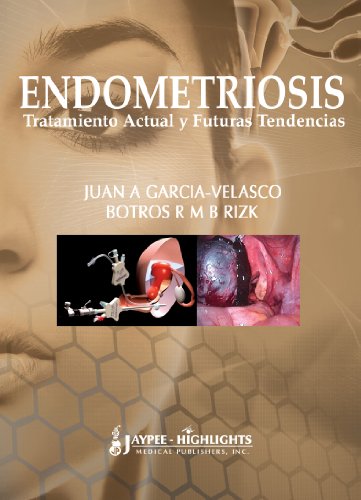 Endometriosis: Tratamiento Actual Y Futuras Tendencias / Current Treatment and Future Trends - Click to Buy