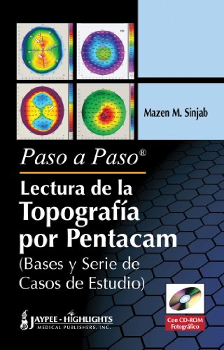 Paso a Paso Lectura De La Topografia Por Pentacam / Step By Step Reading Pentacam Topography - Click to Buy