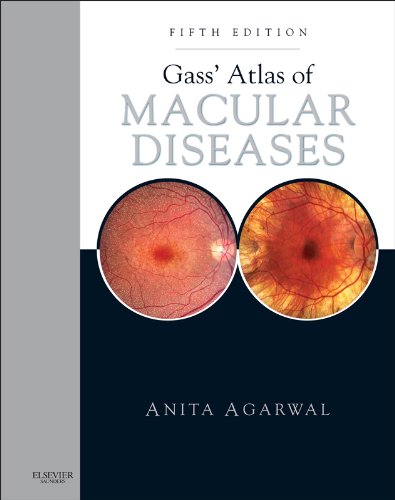 Gass' Atlas of Macular Diseases: 2-Volume Set - Expert Consult: Online and Print - Click to Buy