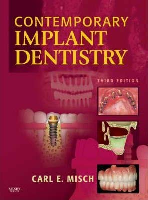 Contemporary Implant Dentistry - Click to Buy