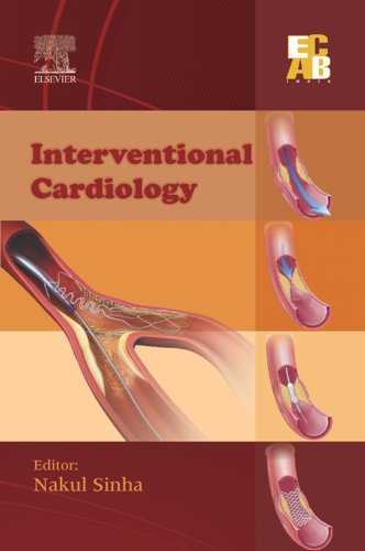 Interventional Cardiology - ECAB - Click to Buy