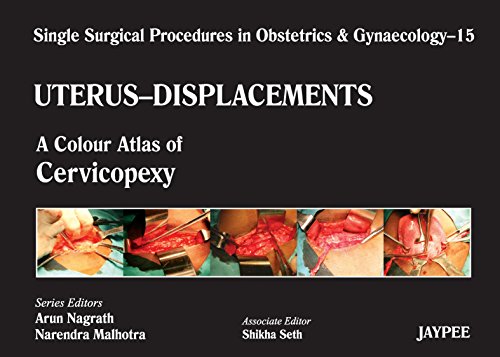 Single Surgical Procedures in Obstetrics and Gynaecology 15: A Colour Atlas of Cervicopexy: Single Surgical Procedures In Obs &Gyne - Click to Buy