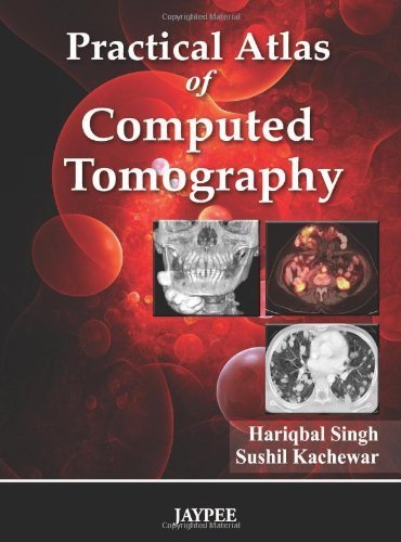 Practical Atlas of Computed Tomography by Hariqbal, M.D. Singh Sushil, M.D. Kachewar(2010-12-01) - Click to Buy
