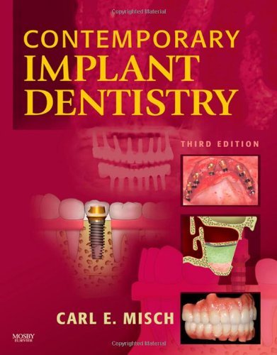 Contemporary Implant Dentistry, 3e by Carl E. Misch DDS MDS PHD(HC) (4-Feb-2008) Hardcover - Click to Buy