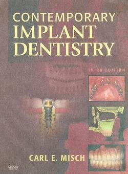 Carl E. Misch: Contemporary Implant Dentistry (Hardcover); 2007 Edition - Click to Buy